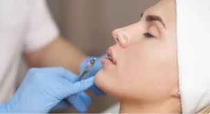 One filler free with each laser session